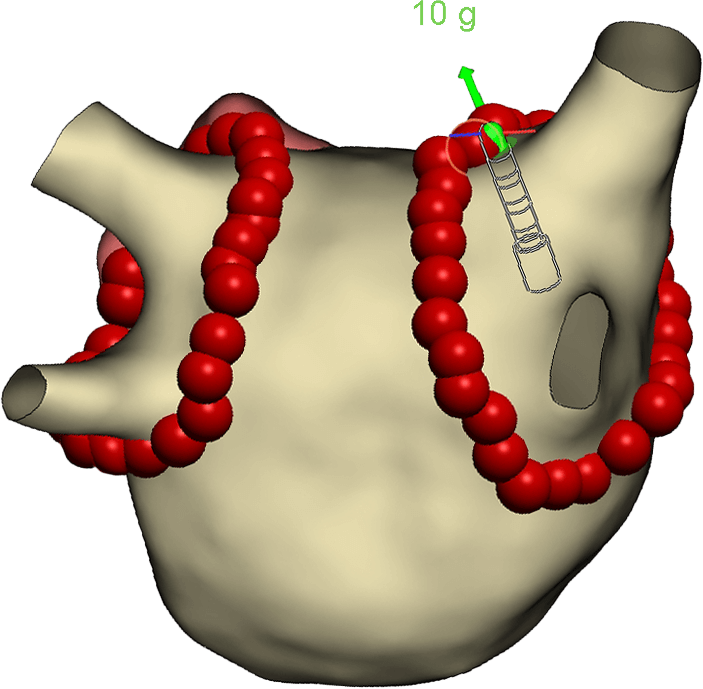 TactiFlex – tvorba lézie