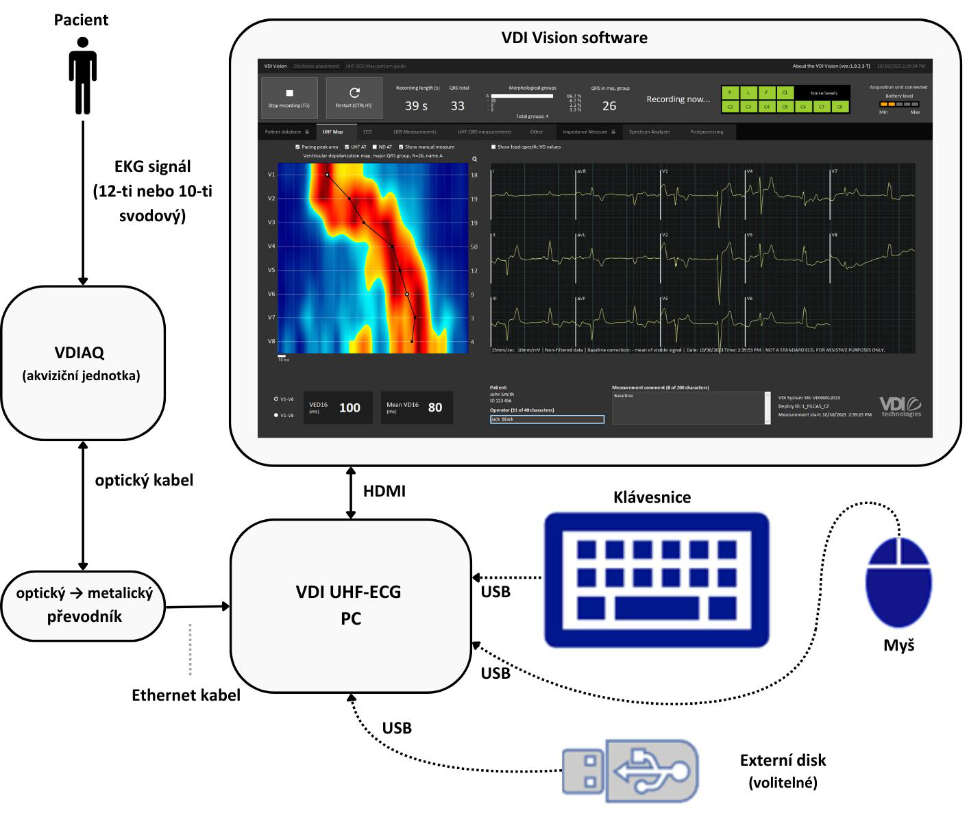 Bloková schéma VDI UHF-ECG
